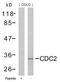 Cyclin Dependent Kinase 1 antibody, 79-559, ProSci, Western Blot image 