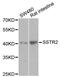 Somatostatin Receptor 2 antibody, A3135, ABclonal Technology, Western Blot image 