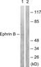 EPH Receptor B1 antibody, PA5-38067, Invitrogen Antibodies, Western Blot image 