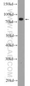 Threonyl-TRNA Synthetase 2, Mitochondrial antibody, 15067-1-AP, Proteintech Group, Western Blot image 