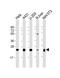 RAB1B, Member RAS Oncogene Family antibody, M04589-1, Boster Biological Technology, Western Blot image 