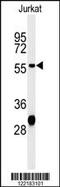 Hydroxyacyl-CoA Dehydrogenase Trifunctional Multienzyme Complex Subunit Beta antibody, 64-152, ProSci, Western Blot image 