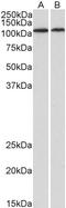 BMP-1 antibody, STJ73107, St John