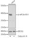 Eukaryotic translation initiation factor 2 subunit 1 antibody, GTX66600, GeneTex, Western Blot image 