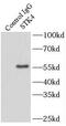 Serine/Threonine Kinase 4 antibody, FNab08339, FineTest, Immunoprecipitation image 