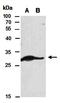 Histone Deacetylase 8 antibody, orb67063, Biorbyt, Western Blot image 