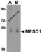 Major Facilitator Superfamily Domain Containing 1 antibody, 6023, ProSci, Western Blot image 