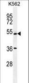 UDP-N-Acetylglucosamine Pyrophosphorylase 1 Like 1 antibody, LS-C160363, Lifespan Biosciences, Western Blot image 