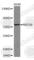 ATP-binding cassette sub-family G member 8 antibody, A1880, ABclonal Technology, Western Blot image 