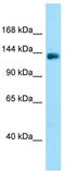 Protein Phosphatase 1 Regulatory Subunit 9A antibody, TA334353, Origene, Western Blot image 