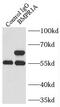 Bone morphogenetic protein receptor type-1A antibody, FNab00922, FineTest, Immunoprecipitation image 
