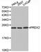 Peroxiredoxin 2 antibody, LS-C192913, Lifespan Biosciences, Western Blot image 