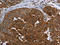 Synuclein Gamma antibody, orb518414, Biorbyt, Immunohistochemistry paraffin image 