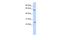 Solute Carrier Family 18 Member A1 antibody, A07692, Boster Biological Technology, Western Blot image 