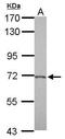 Beta-Secretase 2 antibody, GTX113951, GeneTex, Western Blot image 