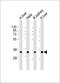 TST antibody, M00965, Boster Biological Technology, Western Blot image 