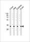 Thiosulfate Sulfurtransferase antibody, M00965, Boster Biological Technology, Western Blot image 