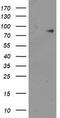 Acyl-CoA Synthetase Short Chain Family Member 2 antibody, TA503632S, Origene, Western Blot image 