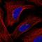 GRB2 Related Adaptor Protein antibody, HPA066654, Atlas Antibodies, Immunofluorescence image 
