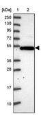 Pregnancy Specific Beta-1-Glycoprotein 11 antibody, PA5-61215, Invitrogen Antibodies, Western Blot image 