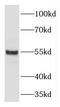 Aspartyl Aminopeptidase antibody, FNab02487, FineTest, Western Blot image 