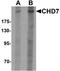 Chromodomain Helicase DNA Binding Protein 7 antibody, TA319962, Origene, Western Blot image 