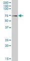 NPL4 Homolog, Ubiquitin Recognition Factor antibody, H00055666-B01P, Novus Biologicals, Western Blot image 