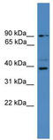 Ubiquitin thioesterase ZRANB1 antibody, TA342580, Origene, Western Blot image 