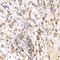 SRSF Protein Kinase 1 antibody, LS-C334342, Lifespan Biosciences, Immunohistochemistry paraffin image 