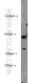 Acid Phosphatase 2, Lysosomal antibody, 15236-1-AP, Proteintech Group, Western Blot image 