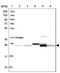 Nipsnap Homolog 3A antibody, NBP2-46674, Novus Biologicals, Western Blot image 