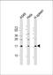 Phospholipase A2 Group IIA antibody, 61-203, ProSci, Western Blot image 