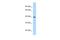 Axin Interactor, Dorsalization Associated antibody, A04989, Boster Biological Technology, Western Blot image 