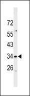 Solute Carrier Family 39 Member 3 antibody, LS-C162840, Lifespan Biosciences, Western Blot image 