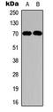 Neurofibromin 2 antibody, LS-C358820, Lifespan Biosciences, Western Blot image 