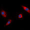 Ribosomal Protein S6 Kinase A1 antibody, LS-C368497, Lifespan Biosciences, Immunofluorescence image 