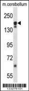 Autophagy Related 2A antibody, 57-177, ProSci, Western Blot image 