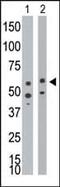 Bmpr antibody, ab38560, Abcam, Western Blot image 