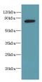 PBX Homeobox Interacting Protein 1 antibody, A60182-100, Epigentek, Western Blot image 