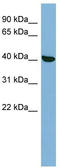 Protein Kinase X-Linked antibody, TA342239, Origene, Western Blot image 