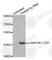 Mitogen-Activated Protein Kinase Kinase 1 antibody, AP0258, ABclonal Technology, Western Blot image 