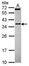 Eukaryotic Translation Initiation Factor 3 Subunit J antibody, PA5-30282, Invitrogen Antibodies, Western Blot image 