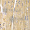 Solute Carrier Family 25 Member 13 antibody, A5849, ABclonal Technology, Immunohistochemistry paraffin image 
