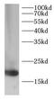 Eukaryotic Translation Initiation Factor 5A antibody, FNab10466, FineTest, Western Blot image 