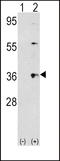 Thrombopoietin antibody, LS-C161864, Lifespan Biosciences, Western Blot image 