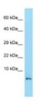 High Mobility Group Nucleosomal Binding Domain 2 antibody, NBP1-98427, Novus Biologicals, Western Blot image 