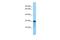 Arginine And Glutamate Rich 1 antibody, A12526, Boster Biological Technology, Western Blot image 