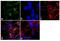 Angiotensin II Receptor Type 2 antibody, GTX79393, GeneTex, Immunocytochemistry image 