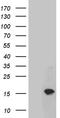 Trefoil Factor 1 antibody, TA804518, Origene, Western Blot image 