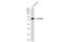ADAM Metallopeptidase Domain 22 antibody, GTX116206, GeneTex, Western Blot image 